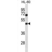 Histone Acetyltransferase Type B Catalytic Subunit (HAT1) Antibody