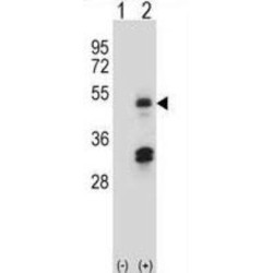 Histone Acetyltransferase Type B Catalytic Subunit (HAT1) Antibody
