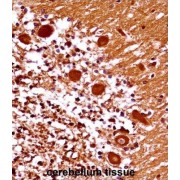 Mesenchyme Homeobox 1 (MEOX1) Antibody