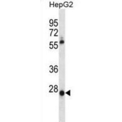 Mesenchyme Homeobox 1 (MEOX1) Antibody