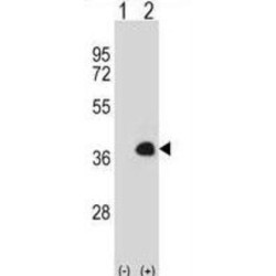 Mesenchyme Homeobox 1 (MEOX1) Antibody