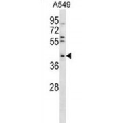 TGFB Induced Factor Homeobox 1 (TGIF1) Antibody