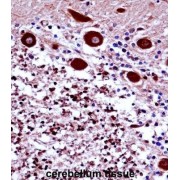 FREQ Antibody