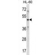 5-Hydroxytryptamine Receptor 1B (HTR1B) Antibody