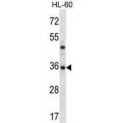 Proteasome Subunit Beta Type 8 (PSMB8) Antibody