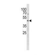 26S Proteasome Regulatory Subunit 7 (PSMC2) Antibody