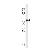 abx028163