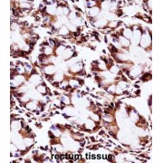 abx028168