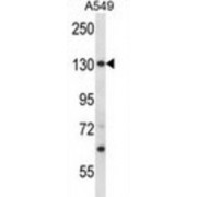 26S Proteasome Non-ATPase Regulatory Subunit 1 (PSMD1) Antibody