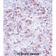 AP2 Associated Protein Kinase 1 (AAK1) Antibody