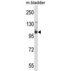 AP2 Associated Protein Kinase 1 (AAK1) Antibody