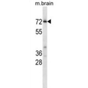 Cyclin Dependent Kinase 17 (Cdk17) Antibody