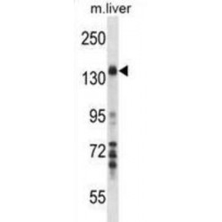 Mitogen-Activated Protein Kinase Kinase Kinase 1 (Map3k1) Antibody