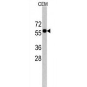 CCR4-NOT Transcription Complex Subunit 4 (CNOT4) Antibody