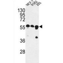 CCR4-NOT Transcription Complex Subunit 4 (CNOT4) Antibody