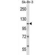 SWI/SNF-Related Matrix-Associated Actin-Dependent Regulator of Chromatin Subfamily A Member 5 (ISWI) Antibody