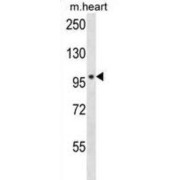 WB analysis of mouse heart tissue lysates.