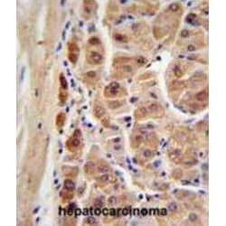 Retinal Dehydrogenase 1 (ALDH1A1) Antibody