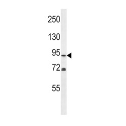 Phospholipase D2 (PLD2) Antibody