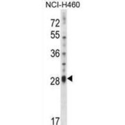 abx028222