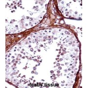 T-Box Protein 5 (TBX5) Antibody