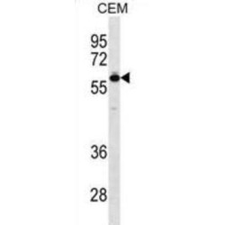 T-Box Protein 5 (TBX5) Antibody