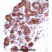 Inosine-5'-Monophosphate Dehydrogenase 1 (IMPDH1) Antibody