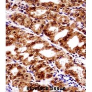 abx028232