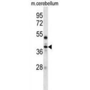Proto-Oncogene Serine/threonine-Protein Kinase Mos (Mos) Antibody
