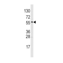 Methylmalonate-Semialdehyde Dehydrogenase [acylating], Mitochondrial (ALDH6A1) Antibody