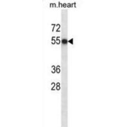 Casein Kinase 1 Delta (Csnk1d) Antibody