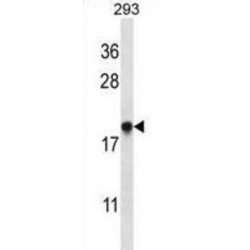 Transmembrane Protein 85 (TMM85) Antibody
