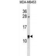 Acyl-CoA Binding Domain Containing 7 (ACBD7) Antibody