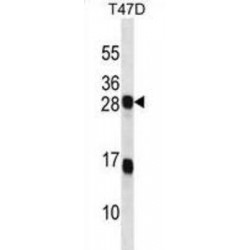 ER Lumen Protein-Retaining Receptor 2 (KDELR2) Antibody