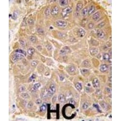 Aldehyde Dehydrogenase 5 Family Member A1 (ALDH5A1) Antibody