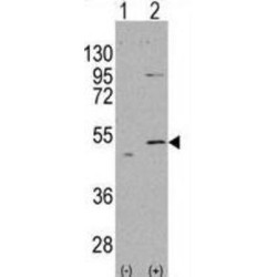 Aldehyde Dehydrogenase 5 Family Member A1 (ALDH5A1) Antibody