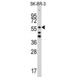 Aldehyde Dehydrogenase 5 Family Member A1 (ALDH5A1) Antibody