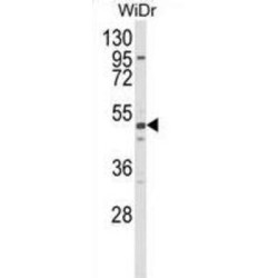 Aldehyde Dehydrogenase 5 Family Member A1 (ALDH5A1) Antibody