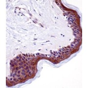 Protein LSM14 Homolog A (LSM14A) Antibody