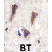 Cadherin 12 (CDH12) Antibody