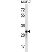 GRB2 Related Adaptor Protein 2 (GRAP2) Antibody