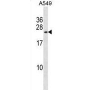 Potassium Calcium-Activated Channel Subfamily M Regulatory Beta Subunit 1 (KCNMB1) Antibody