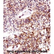 Epithelial Cell Transforming Sequence 2 (ECT2) Antibody