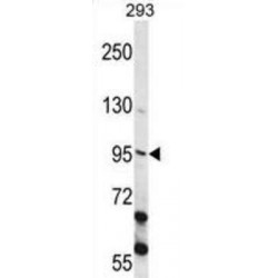 Epithelial Cell Transforming Sequence 2 (ECT2) Antibody
