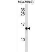 Cellular Retinoic Acid Binding Protein 2 (CRABP2) Antibody