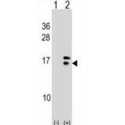 Cellular Retinoic Acid Binding Protein 2 (CRABP2) Antibody
