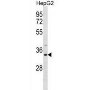 WB analysis of HepG2 cells.