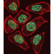 Transcriptional Adaptor 3 (TADA3L) Antibody
