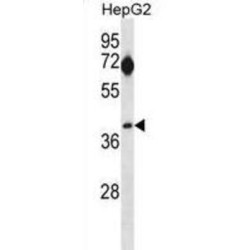 Septin 5 (SEPTIN5) Antibody