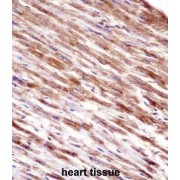 Heat Shock Protein-Binding Protein 1 (HSPBP1) Antibody